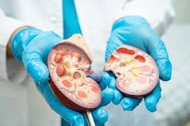 Annual Kidney Disease Testing Urged for High-Risk Individuals, Says Expert