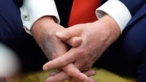 Trump health concerns