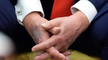 Trump health concerns