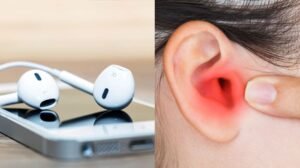 Earbud Overuse Raises Hearing Loss and Health Risks